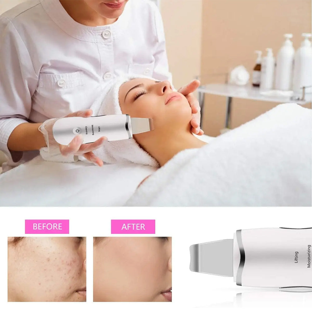 Health & Beauty 3-in-1 Ultrasonic Facial Spatula for Deep Cleansing, Electric Ultrasonic Skin Scrubber